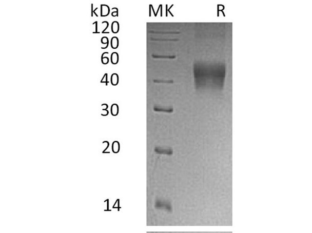 Human IL-21R Recombinant Protein (RPES2794)