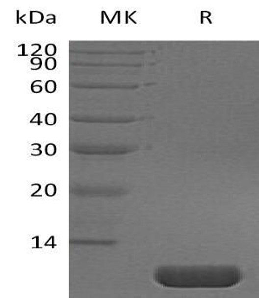 Pro-Neuregulin/NRG1-beta 1 Recombinant Protein (RPES2808)
