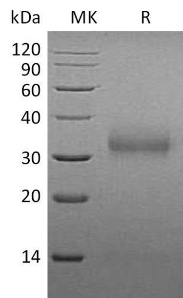 Mouse Sclerostin/SOST Recombinant Protein (RPES2811)