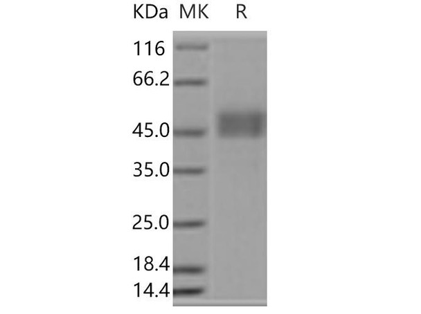 CD3D & CD3E Heterodimer Recombinant Protein  (RPES2817)