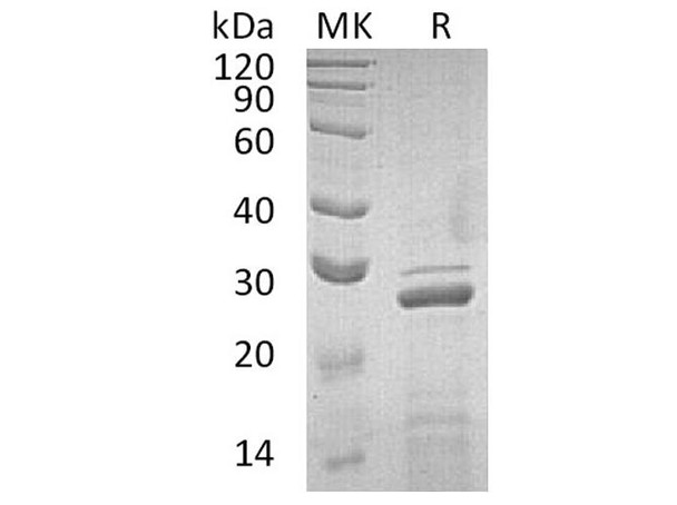Apolipoprotein A-I/ApoAI Recombinant Protein (RPES2825)