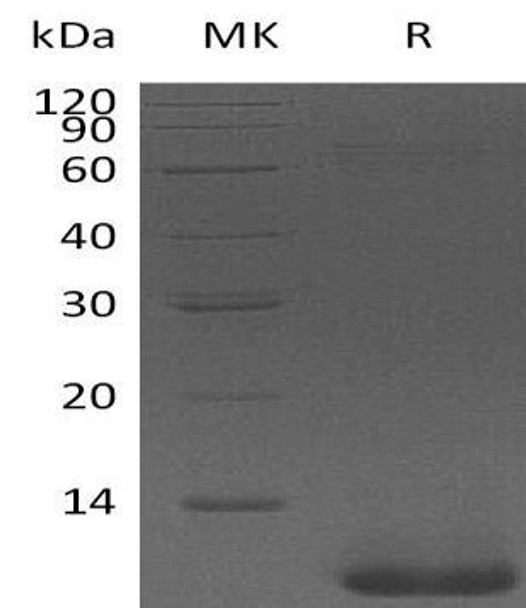 Pro-Neuregulin/NRG1-beta 1 Recombinant Protein (RPES2828)