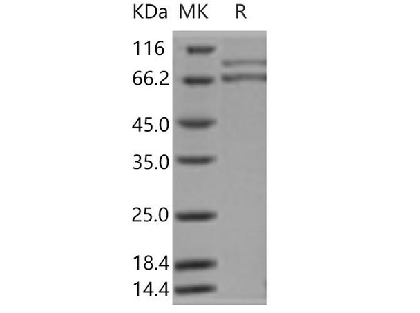 Human XRCC5 & XRCC6 Heterodimer Recombinant Protein (RPES2837)