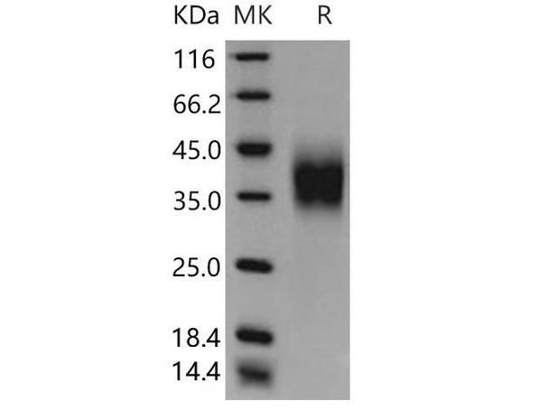 Mouse CD16 Recombinant Protein (RPES2843)