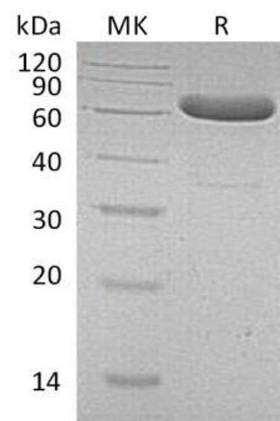 Human EpCAM/TROP Recombinant Protein (RPES2868)