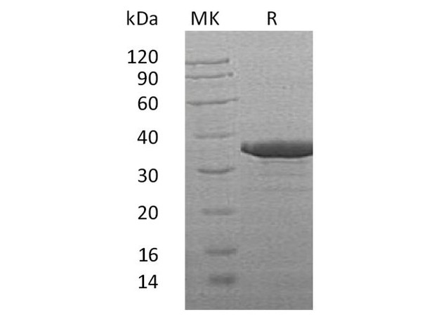 Human SULT2B1 Recombinant Protein (RPES2876)