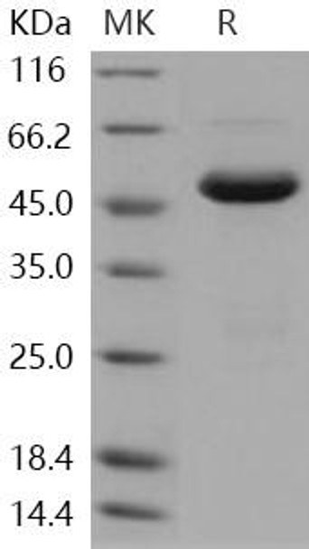 Human SETD7/SET7/9 Recombinant Protein (RPES2881)