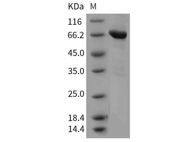 Mouse Tie2/CD202b Recombinant Protein (RPES2884)