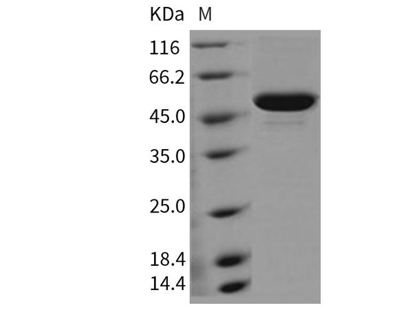 Mouse SES1D Recombinant Protein  (RPES2893)