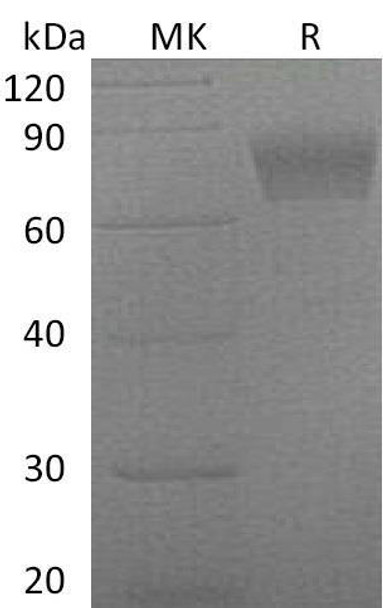 Mouse SerpinF2/SERPINF2 Recombinant Protein (RPES2894)