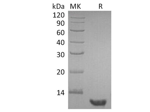 Human EGF Recombinant Protein  (RPES2898)