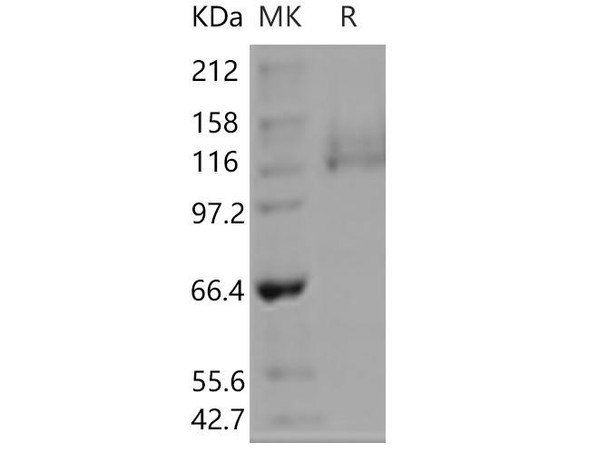 ITGA6 & ITGB1 Heterodimer Recombinant Protein (RPES2900)