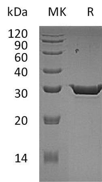 Human 15-PGDH Recombinant Protein (RPES2902)