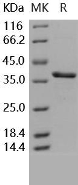 Carbonic Anhydrase 8/CA8 Recombinant Protein (RPES2903)