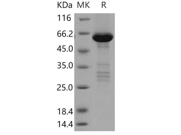 Human TRIB2/TRB2 Recombinant Protein (RPES2907)