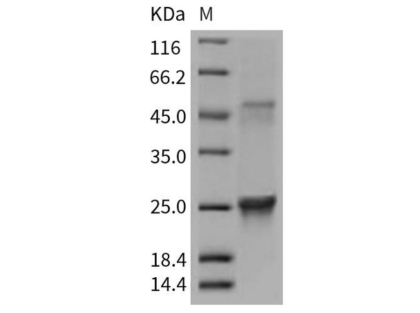 Mouse GLO1/Glyoxalase 1 Recombinant Protein (RPES2914)