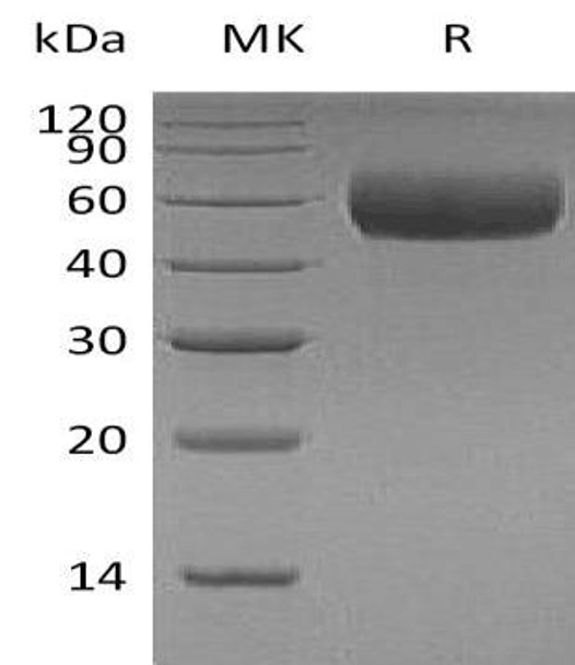 Human Apolipoprotein H/ApoH Recombinant Protein (RPES2929)