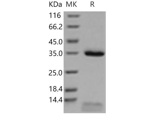 FCGRT & B2M Heterodimer Recombinant Protein  (RPES2940)