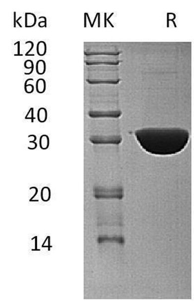 Human Ketohexokinase/KHK Recombinant Protein (RPES2949)