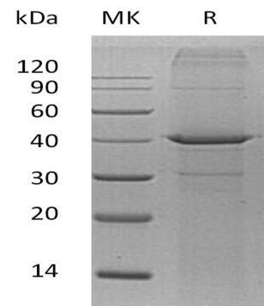 Human Arginase-2/ARG2 Recombinant Protein (RPES2967)