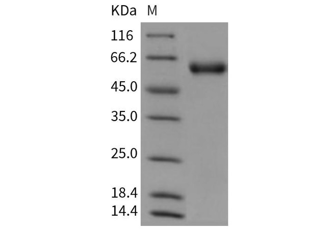 Mouse SerpinA8/AGT Recombinant Protein (RPES2990)