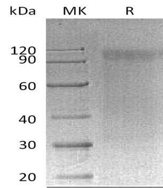 Mouse SIRPA/CD172a Recombinant Protein (RPES2991)