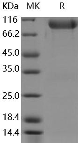 Human FGFR3/CD333 Recombinant Protein (RPES2996)