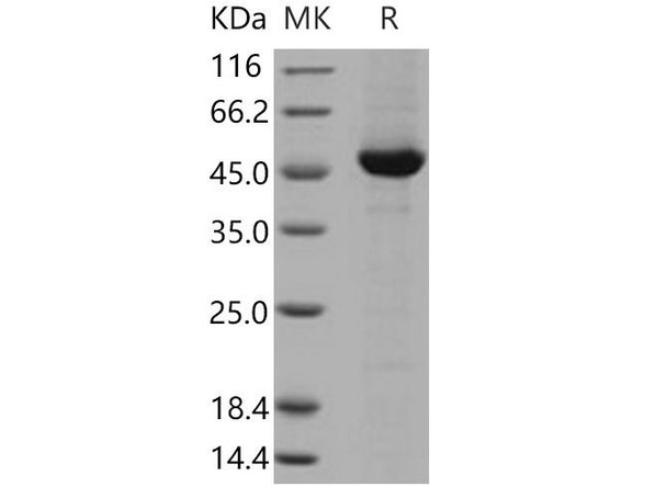 Human DOPA Decarboxylase/DDC Recombinant Protein (RPES3001)