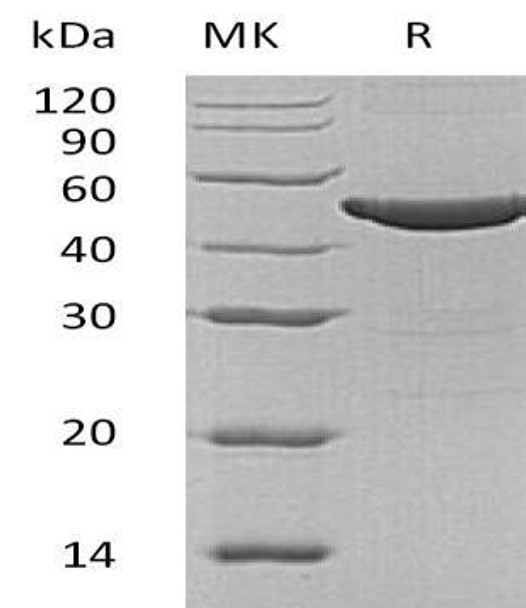 Human ASS1 Recombinant Protein (RPES3002)