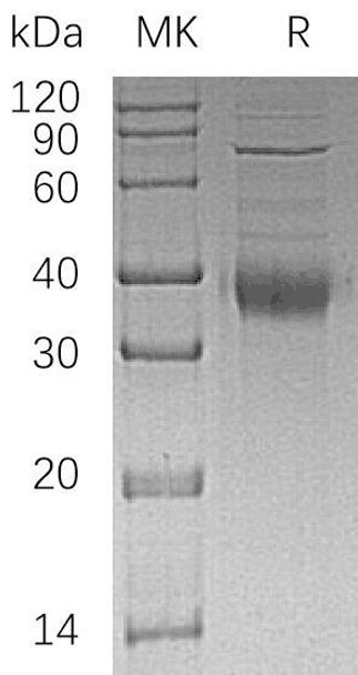 Human KIR2DL4/CD158D Recombinant Protein (RPES3004)