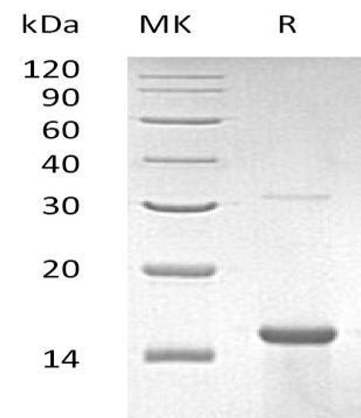 Human ZNF100 Recombinant Protein (RPES3006)