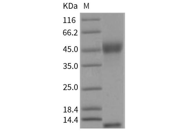 Rat FCGRT & B2M Heterodimer Recombinant Protein (RPES3038)