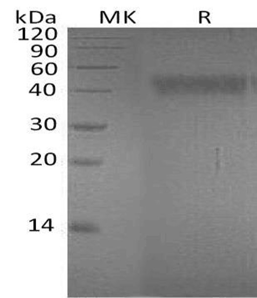 Human Ephrin-A4/EFNA4 Recombinant Protein (RPES3044)