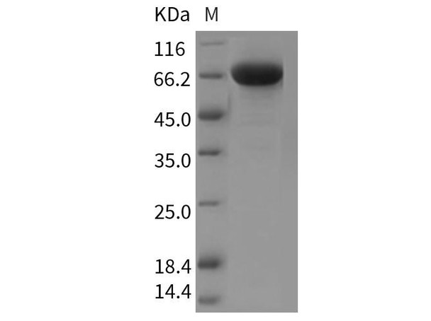 Mouse PGRL/IGSF8 Recombinant Protein (RPES3059)