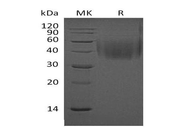 Mouse 2B4/CD244 Recombinant Protein (RPES3069)