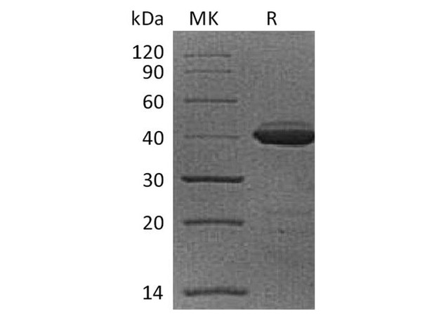 Cynomolgus B2M Recombinant Protein (RPES3075)