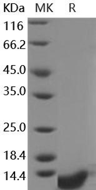 Human COL6A3/Collagen-VI Recombinant Protein (RPES3076)