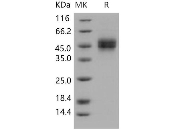 Human MICB Recombinant Protein (RPES3082)