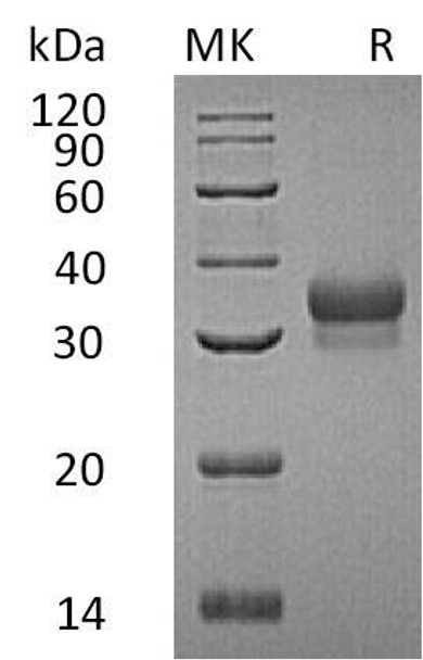 Human Ephrin-B1/EFNB1 Recombinant Protein (RPES3084)