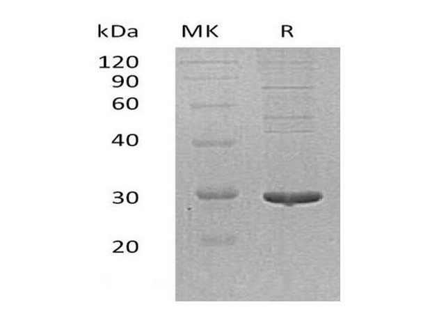 Human PDIA5 Recombinant Protein (RPES3106)