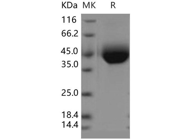 Human SIGLEC3/CD33 Recombinant Protein (RPES3116)