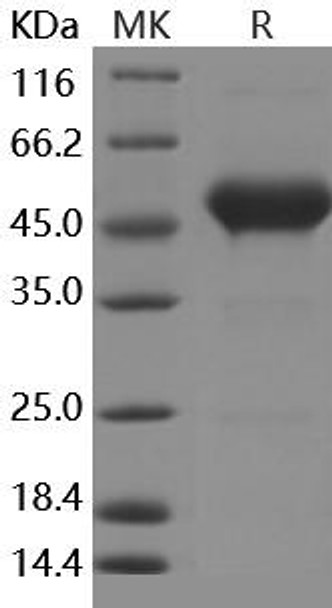 Human CD90/THY Recombinant Protein (RPES3122)