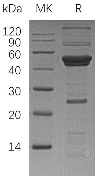Human ATG4A Recombinant Protein (RPES3144)