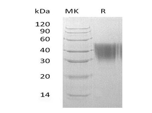 Human ORM2 Recombinant Protein (RPES3148)