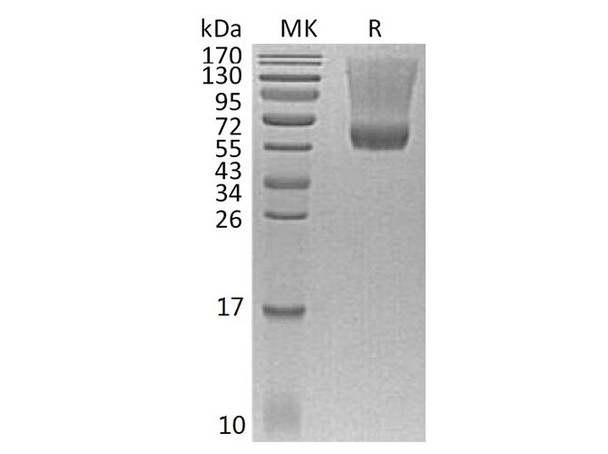 Human Decorin Recombinant Protein (RPES3154)