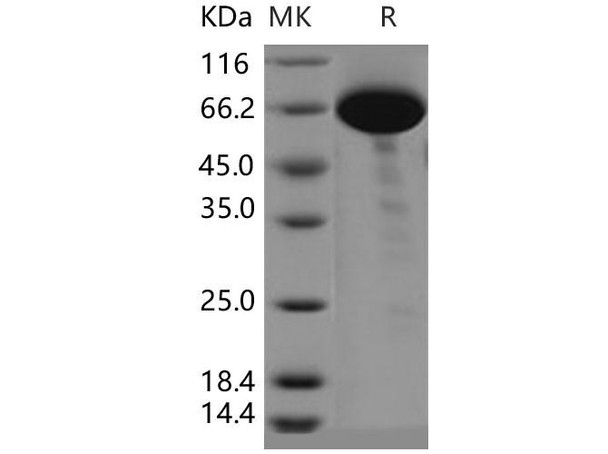 Human COL9A1 Recombinant Protein (RPES3157)