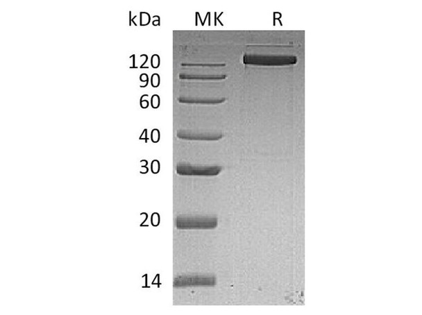 Human EGFR/ErbB1 Recombinant Protein (RPES3165)