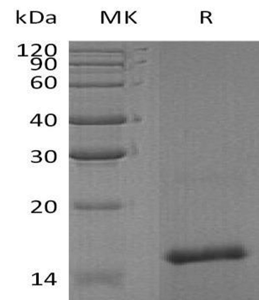 Human FAM19A4 Recombinant Protein (RPES3167)