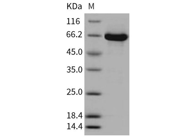 Mouse MEK1/MAP2K1/MKK1 Recombinant Protein (RPES3169)