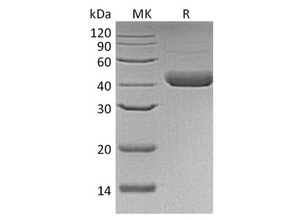 Human Decorin Recombinant Protein (RPES3173)